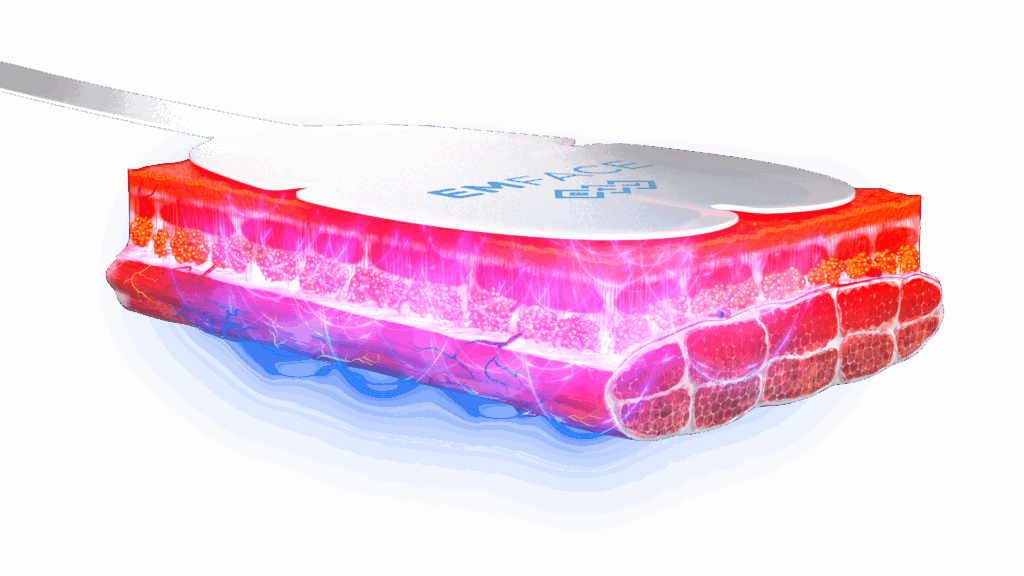 Emface PIC Applicator