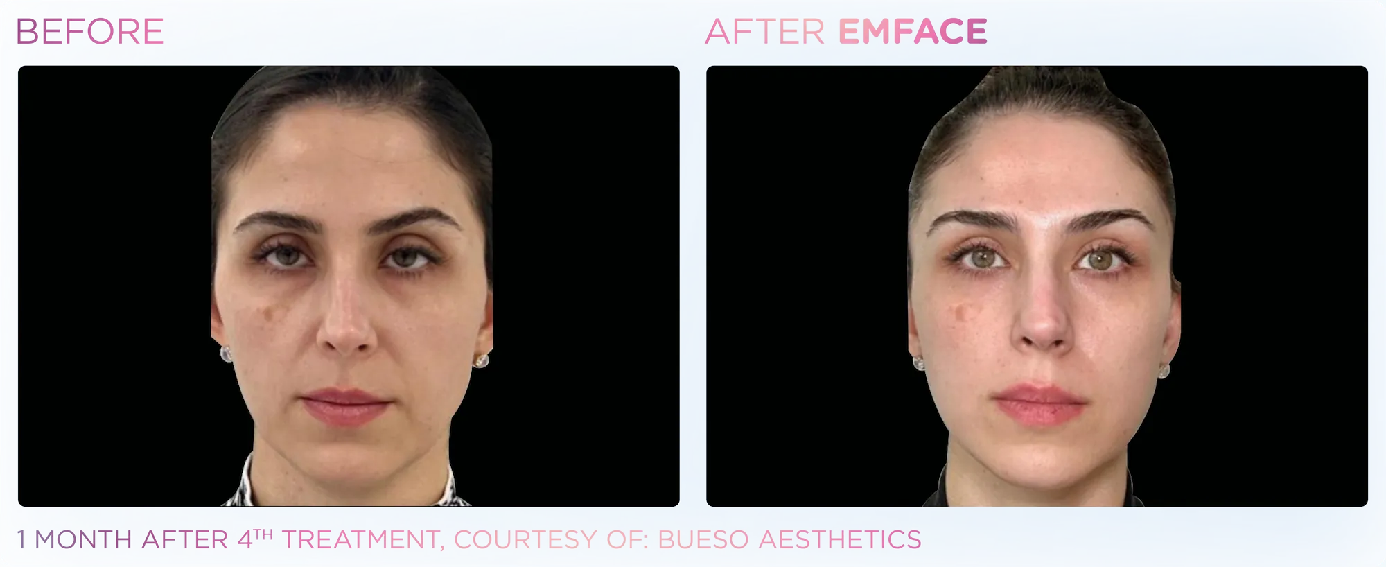 Emface_PIC_Ba-card-female-face-101_ENUS100 (1)